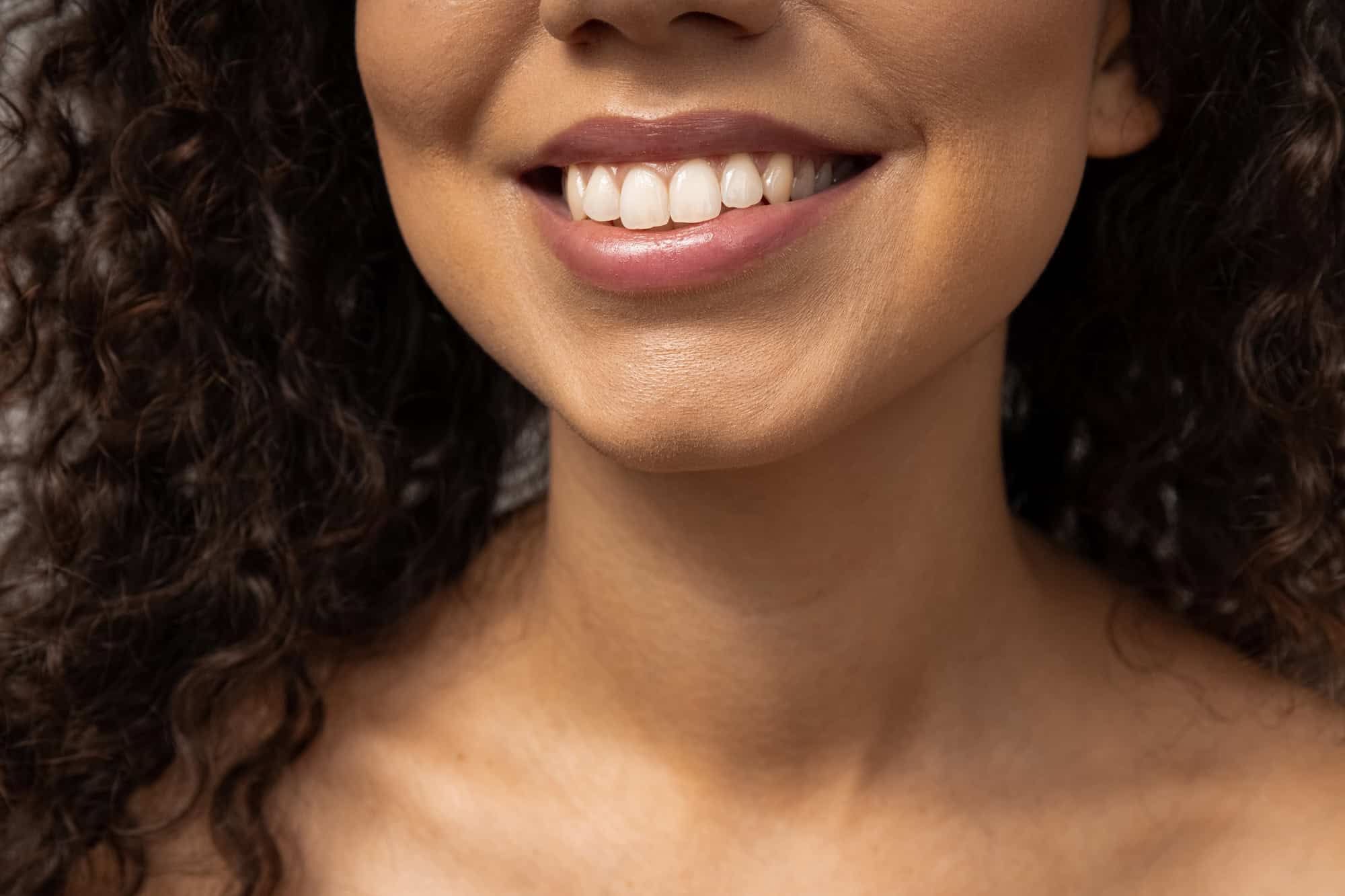 Front Teeth Crowns