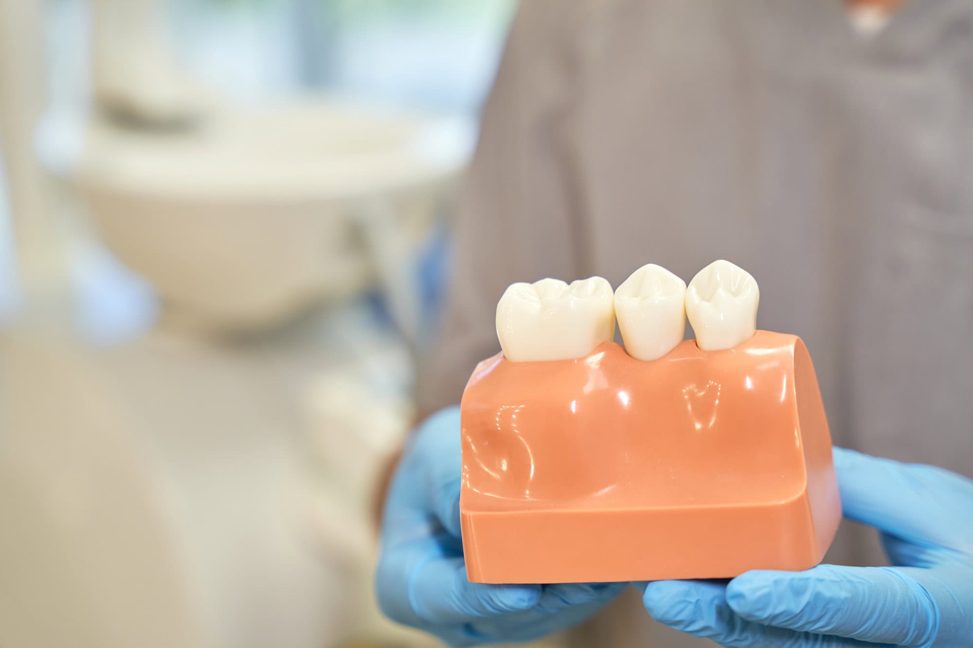 Everything You Need to Know About Dental Crowns