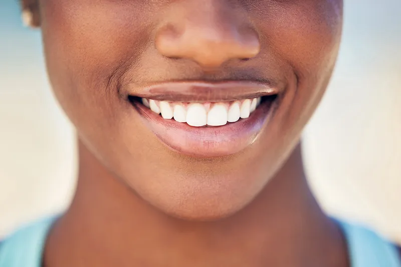 Close-up of healthy gums after preventive dental care
