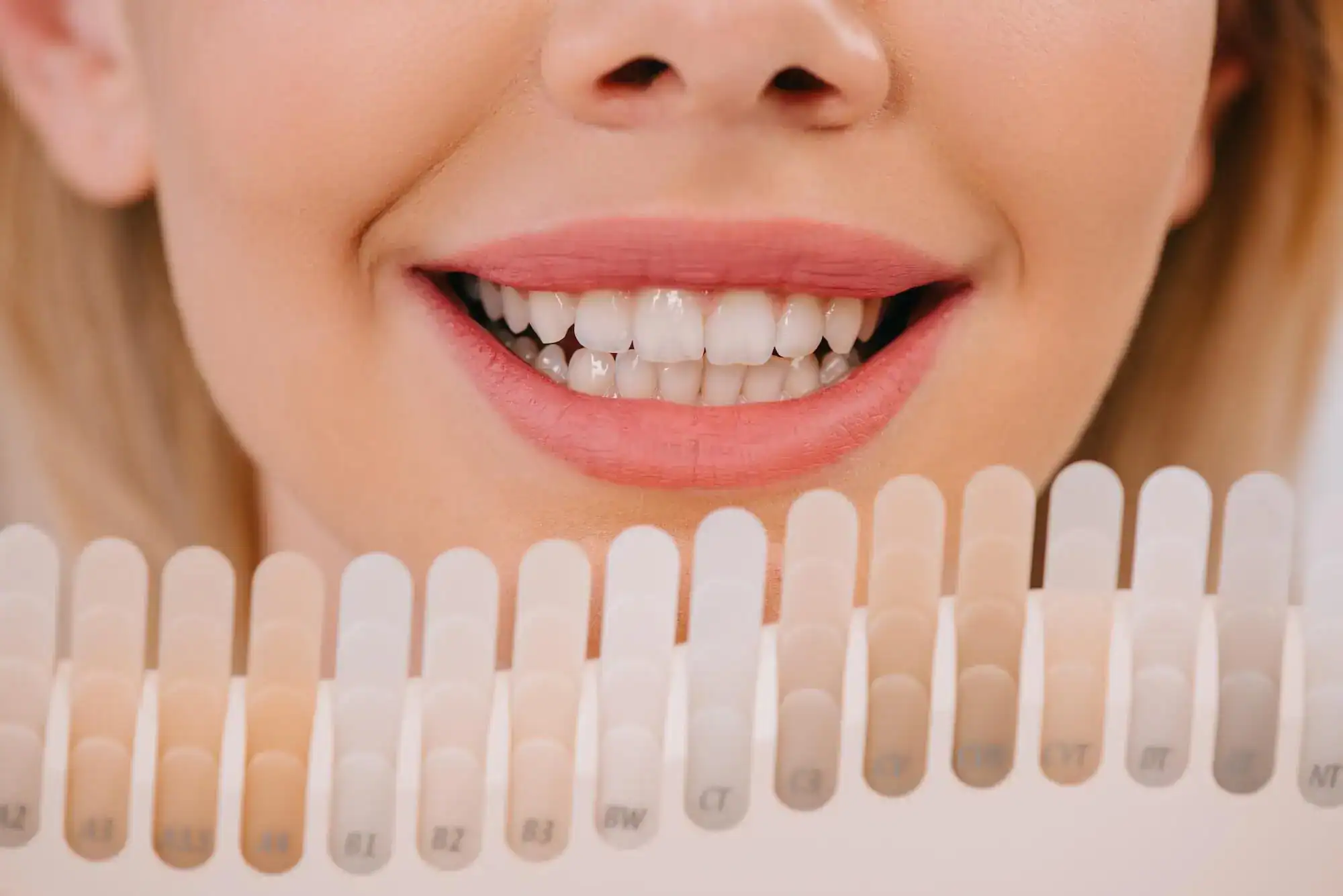 Smiling patient at a dental office discussing teeth whitening options