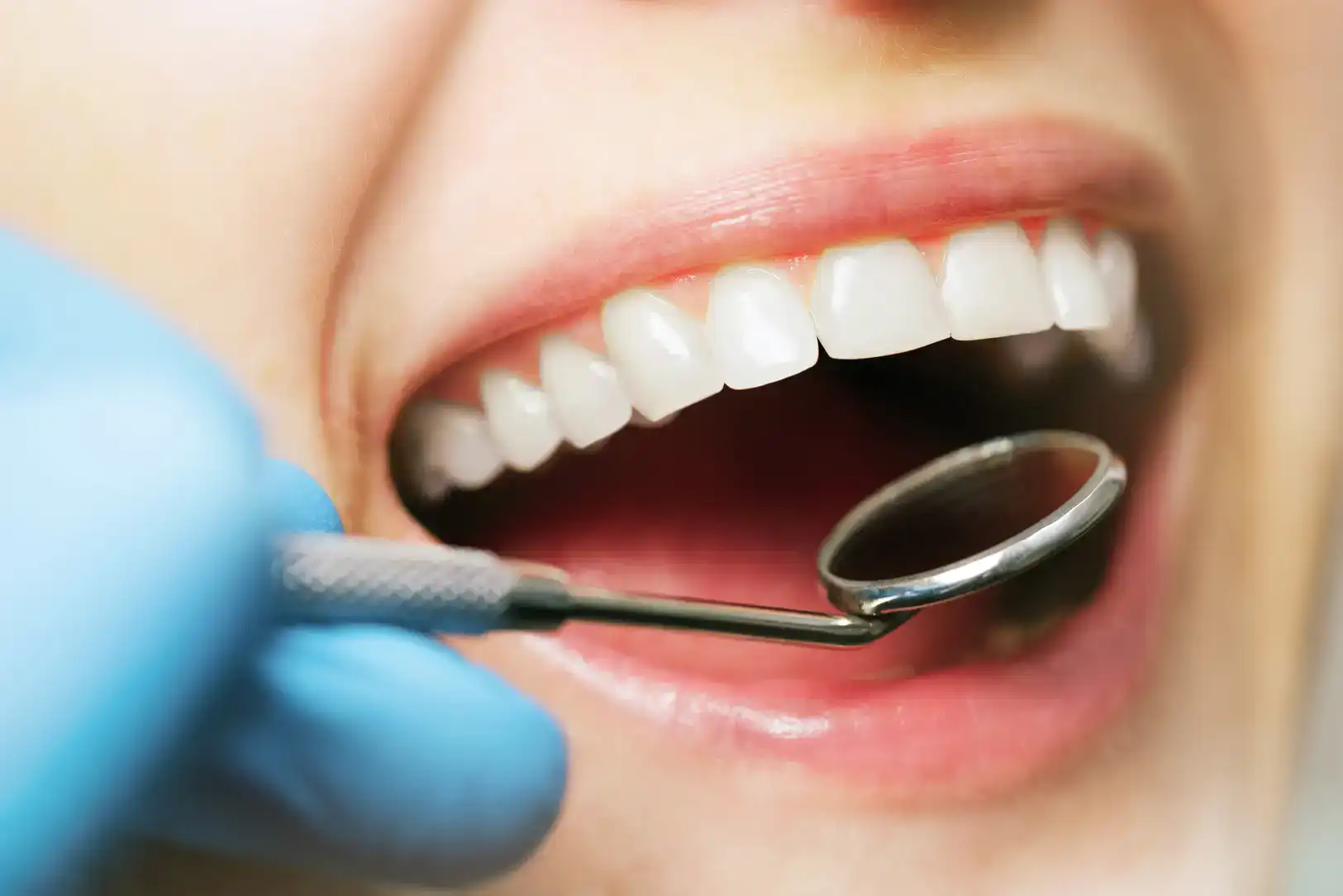Dental exam with mirror showing how often to see a dentist for preventative care